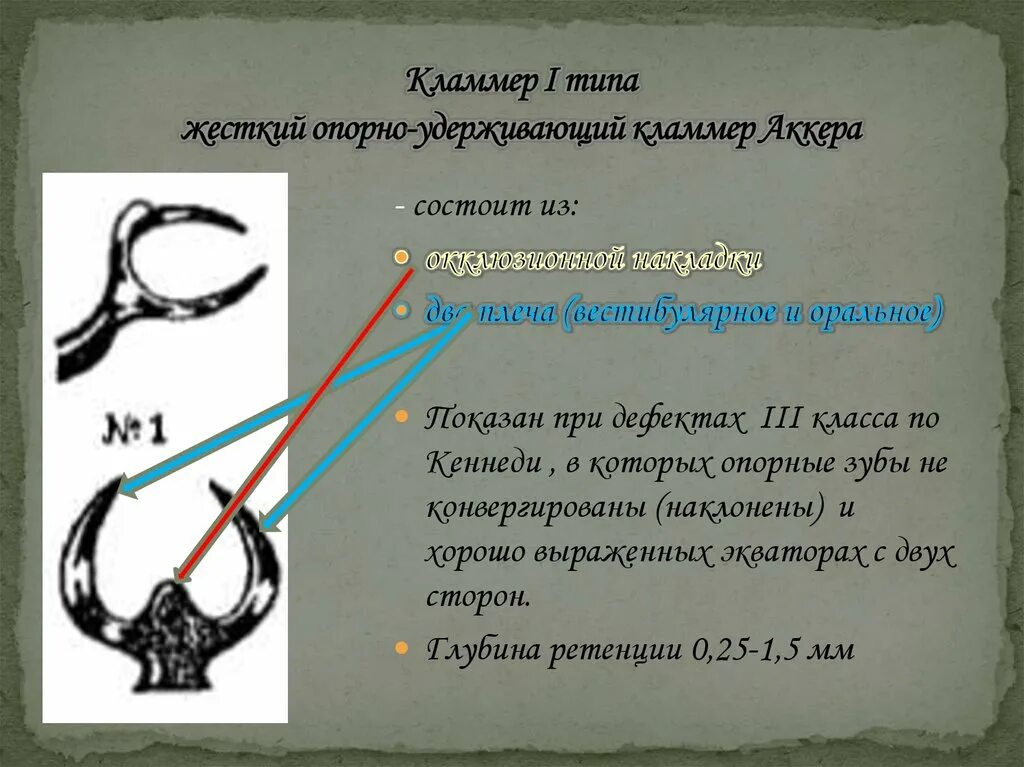 Части опорно удерживающего кламмера. 5 Тип опорно-удерживающего кламмера нея. Кламмер Аккера 1 типа. Опорно удерживающий кламмер. Код гнута