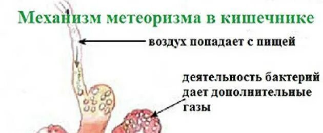 Как убрать газы из кишечника