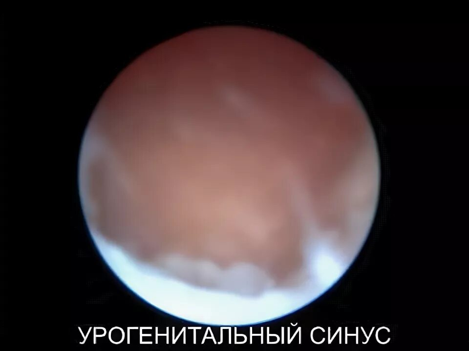 Урогенитальный синус. Уроректальная складка. Мышцы тазового дна у женщин анатомия схема. Урогенитальный синус. Урогенитальный синус и клоака развитие.