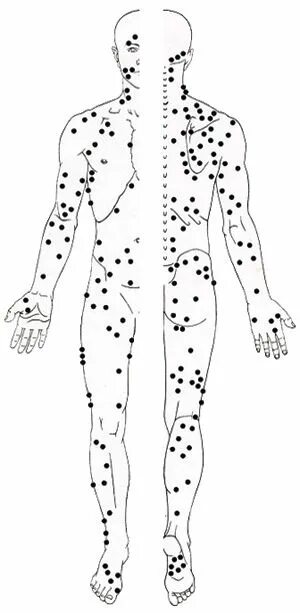 Точка спереди. Триггерные точки на теле человека. Карта триггерных точек. Триггерные точки туловища. Иглоукалывание триггерных точек.