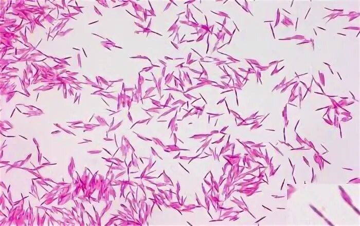 Fusobacterium spp. Фузобактерии нуклеатум. fusobacterium spp микроскопия. fusobacterium nucleatum (палочка плаута). фузобактерии морфология.