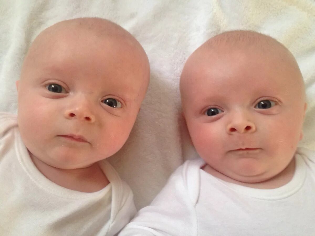 Однояйцевые близнецы пол. Однояйцевые (монозиготные) Близнецы. Двуяйцевые Близнецы. Разнояйцевые двойняшки. Близнецы это однояйцевые дети.