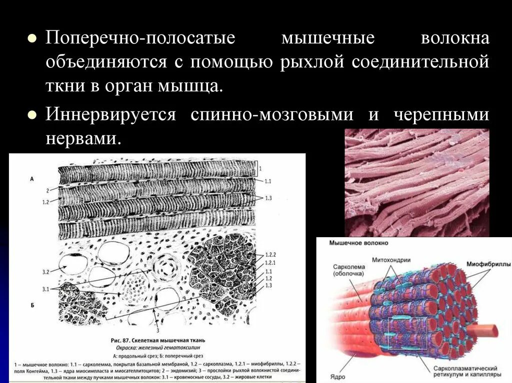 Волокна поперечно полосатой мышечной ткани ядра. Поперечно Скелетная мышечная ткань. Рисунок волокна поперечнополосатой мышечной ткани. Поперечно полосатые волокна. Поперечно полосатое мышечное волокно.