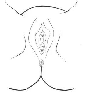 Image: Vaginal opening. 