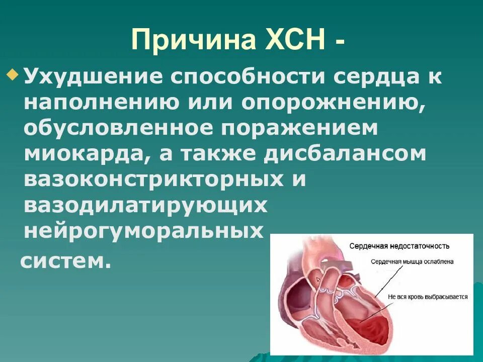 Сердечная недостаточность. Сердечный недостаточность. Хроническая сердечно-сосудистая недостаточность. Причины ХСН. Хроническая сердечная недостаточность положение