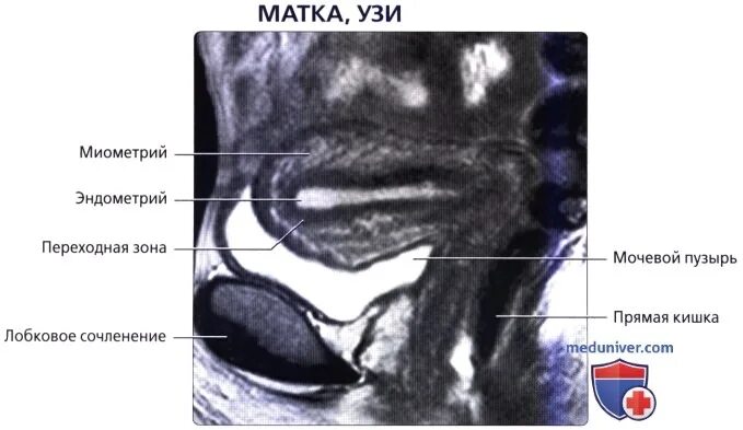 Расположение матки и мочевого пузыря. Анатомия шейки матки мрт. Шейка матки анатомия мрт.
