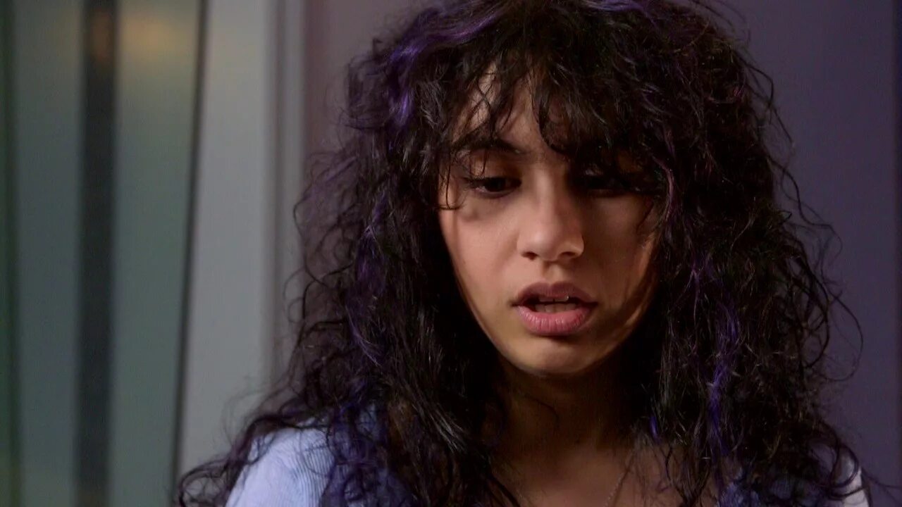 Alessia cara scars. Алессия Синискальчи. Алессия Элефанте.