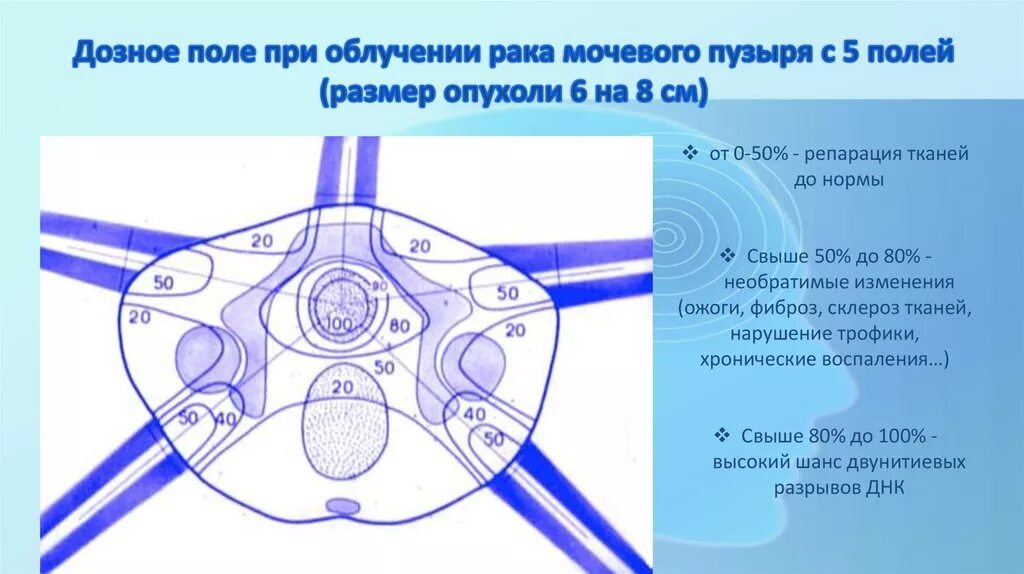 Лучевая химиотерапия при раке. Аппарат внутриполостной лучевой терапии. Методы лучевой терапии. Лучевая терапия при опухолях. Планирование лучевой терапии.