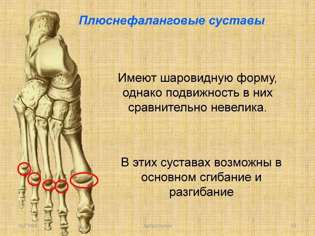 Артроз плюсне фалангового сустава. Артрит плюснефалангового сустава рентген. Артрит артроз плюснефалангового сустава стопы. Артроз плюсне фалангового сустава. Артроз 1 плюснефалангового сустава стопы.