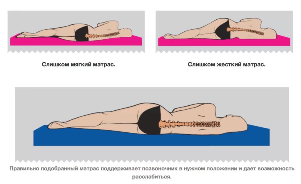 Правильный матрас для позвоночника. Правильный матрас при остеохондрозе. Жёсткий матрас для спины. Матрас при остеохондрозе позвоночника. Почему тело мягкое