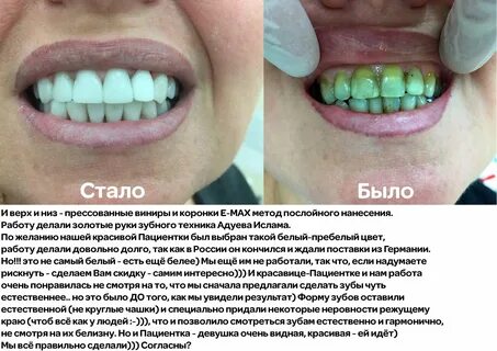 Сделать зубы тверь
