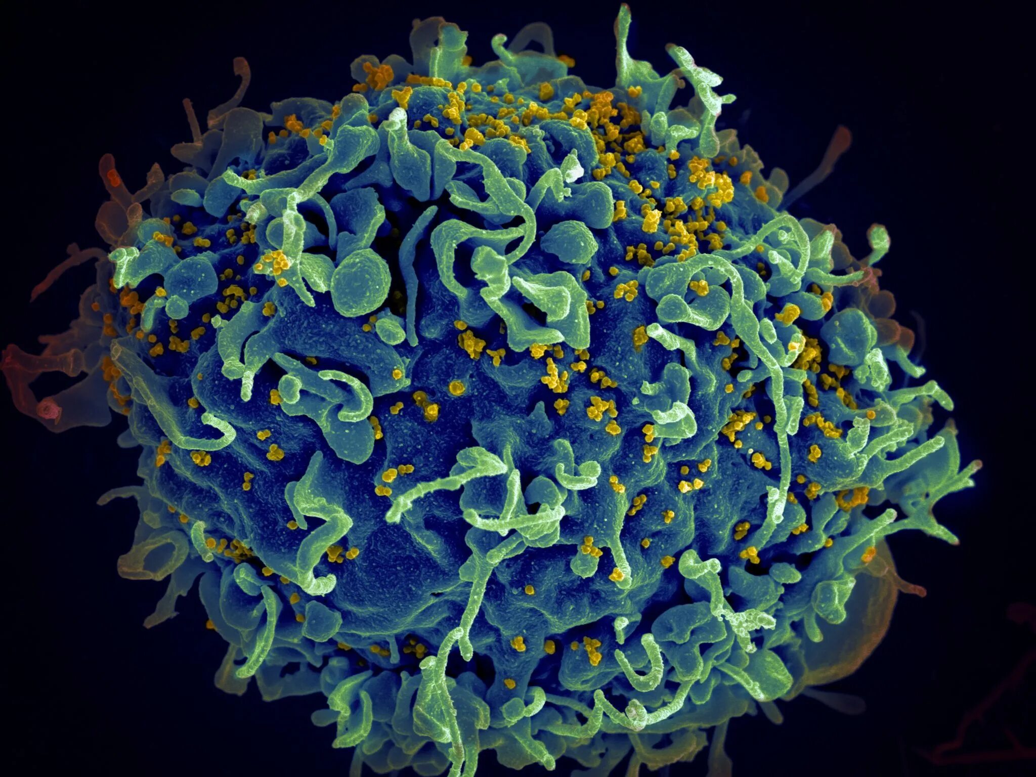 Вирус ВИЧ под микроскопом. Т-лимфоциты ВИЧ микроскоп. Вирус иммунодефицита человека (Human Immunodeficiency virus). HIV вирус.