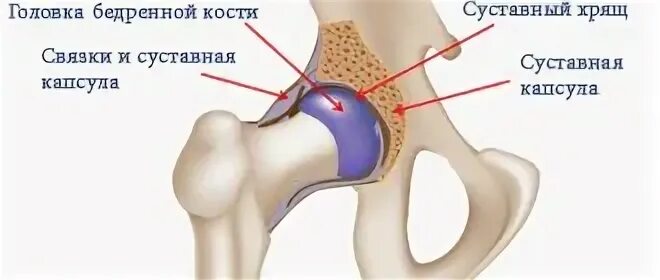 Замена сустава инвалидность