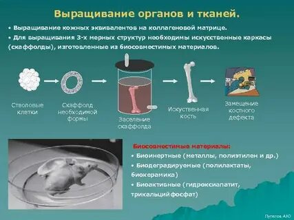 Вне орган