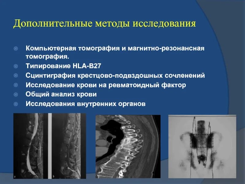 Заболевание кт