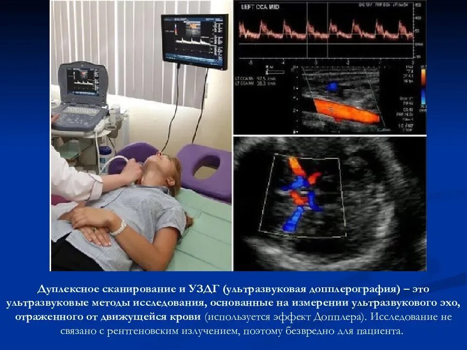 Допплерография ребенку. Ультразвуковая допплерография сосудов головного мозга. Ультразвуковая допплерография сосудов шеи. УЗДГ – ультразвуковая допплерография сосудов. УЗИ дуплексное сканирование сосудов шеи.