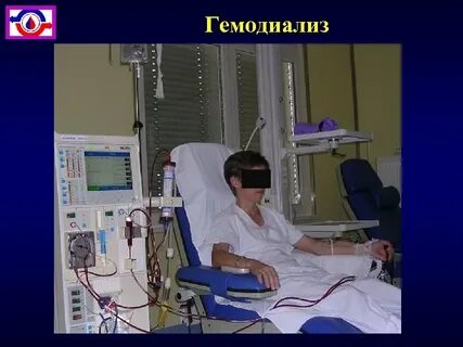 Гемодиализ суть