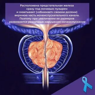 Что такое фиброз предстательной железы
