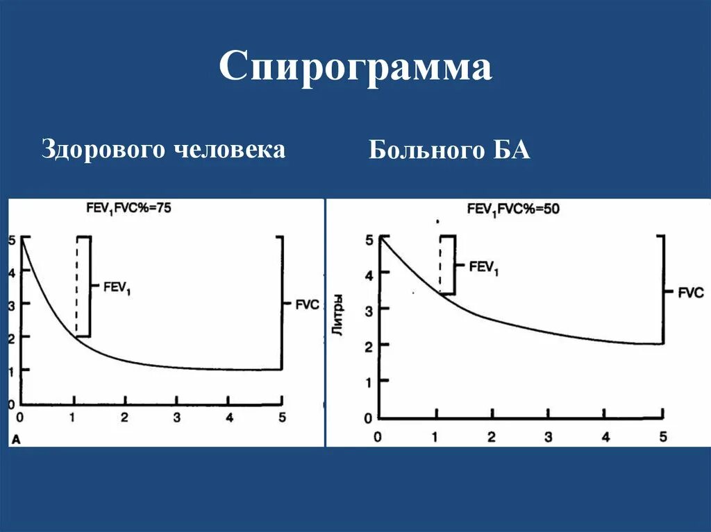 Спирометрия при хобл показатели. Показатели фвд у больных хобл. Нормы показателей фвд у детей. Спирограмма объем форсированного воздуха. Спирометрия трактовка результатов.