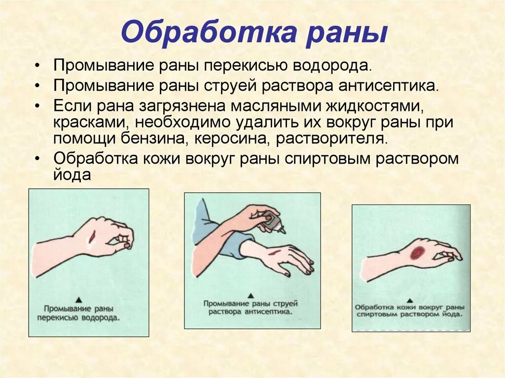 чем лечить раны ребенку. антисептики для обработки раны. антисептическое средство для обработки. чем лечить раны ребенку. ссадина на коленке чем лечить.