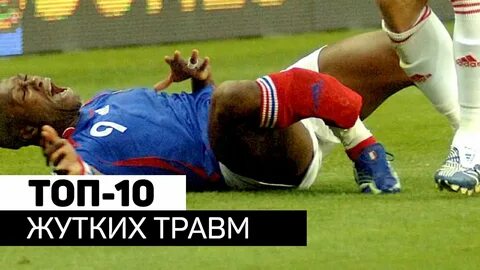 Включи травма
