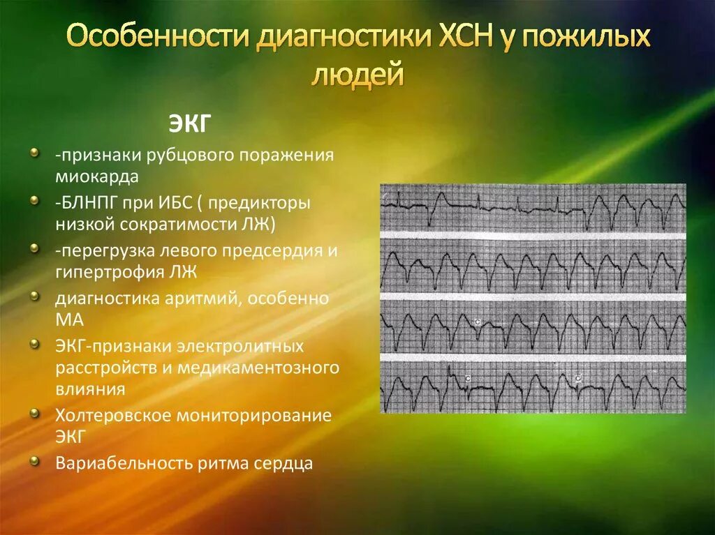 Диагноз хронической сердечной недостаточности. Хроническая сердечная недостаточность на ЭКГ. ЭКГ при хронической сердечной недостаточности. Изменения на ЭКГ при ХСН. ЭКГ при хронической коронарной недостаточности.