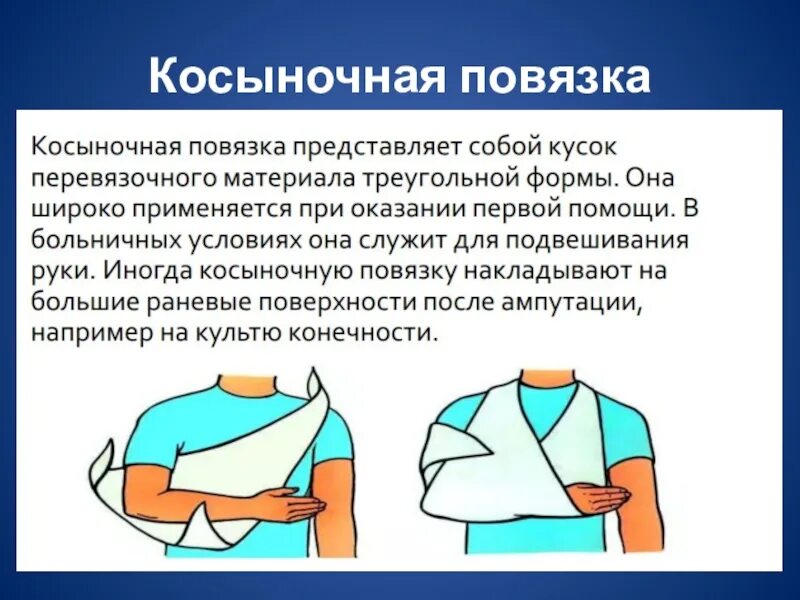 Помощь при перевязке. Косыночная повязка алгоритм наложения. Повязка косынка на руку алгоритм. Повязка Косыночная универсальная ПКУ-01. Повязка косынка на верхнюю конечность.