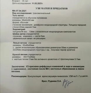 Через сколько пойдут месячные после прерывания