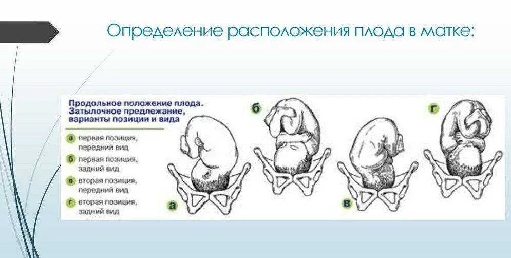 Ребенок расположен справа. Продольное головное предлежание плода. Вид позиция предлежание плода. Головное предлежание положение продольное вид передний. Положение плода продольное предлежание головное.