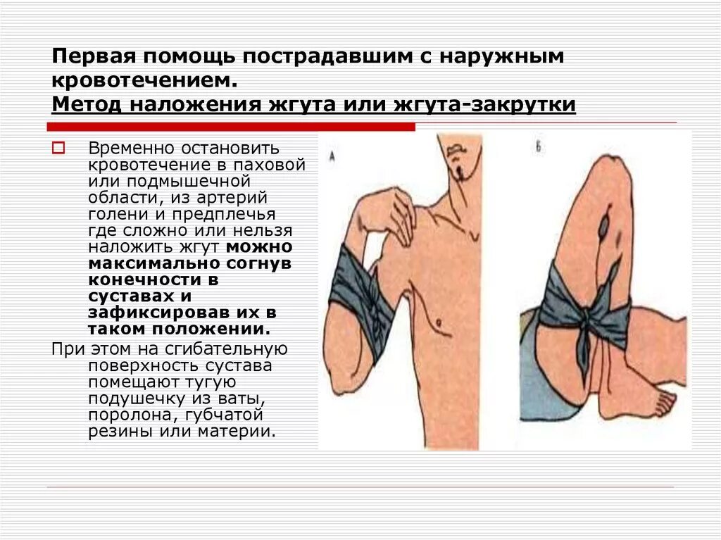 Пострадавшему с сильным наружным кровотечением. Остановка кровотечения накладывание жгута;. Способы временной остановки наружного кровотечения. Способ остановки артериального кровотечения жгутом.. При кровотечении из предплечья.