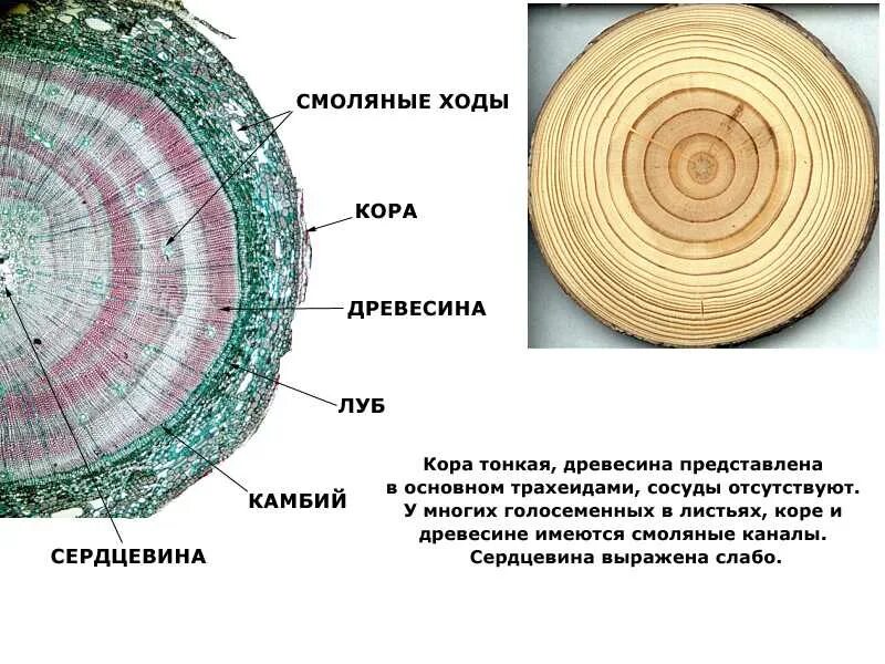 Данные поперечного среза. Внутреннее строение голосеменных растений. Строение стебля голосеменных растений. Строение древесины голосеменных растений. Поперечный срез стебля сосны.