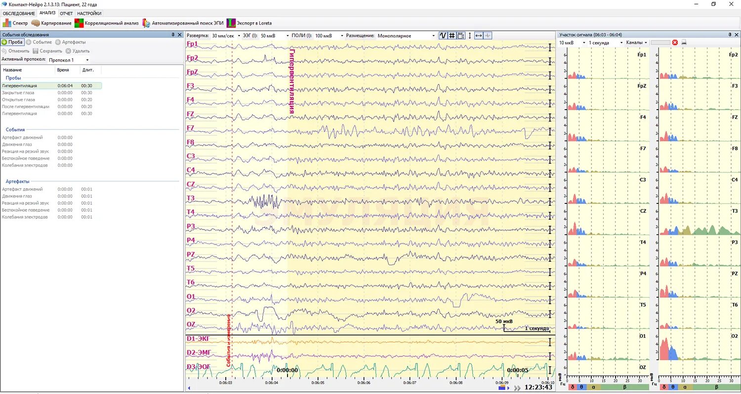 Водительский ээг. Компакт-Нейро 16-канальный. Система электроэнцефалографическая «компакт-Нейро» 21 канал. Компакт-Нейро 21 канальный. ЭЭГ компакт Нейро.