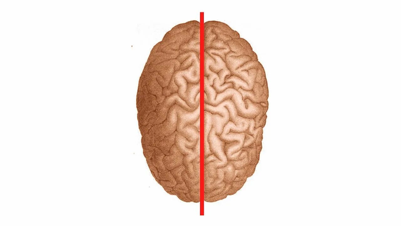 Split brain. Левое и правое полушарие мозга. Полушария мозга красивые. Синдром расщепленного мозга.