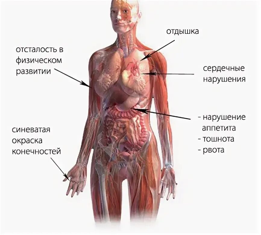 Симптомы всд в стадии. Нейроциркуляторная дистония симптомы. вегетососудистые расстройства это. нейроциркуляторная астения по кардиальному типу. нцд симптомы.