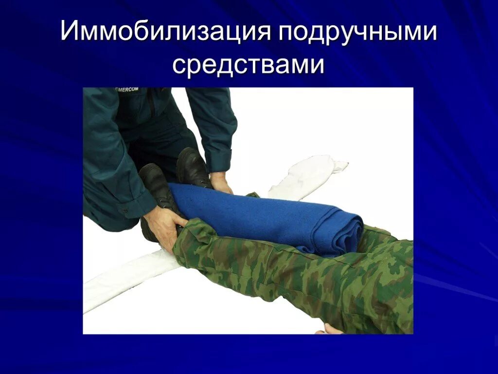 Первая помощь подручными средствами. Иммобилизация. средства иммобилизации подручные средства. иммобилизация подручными средствами. подручные средства при иммобилизации.