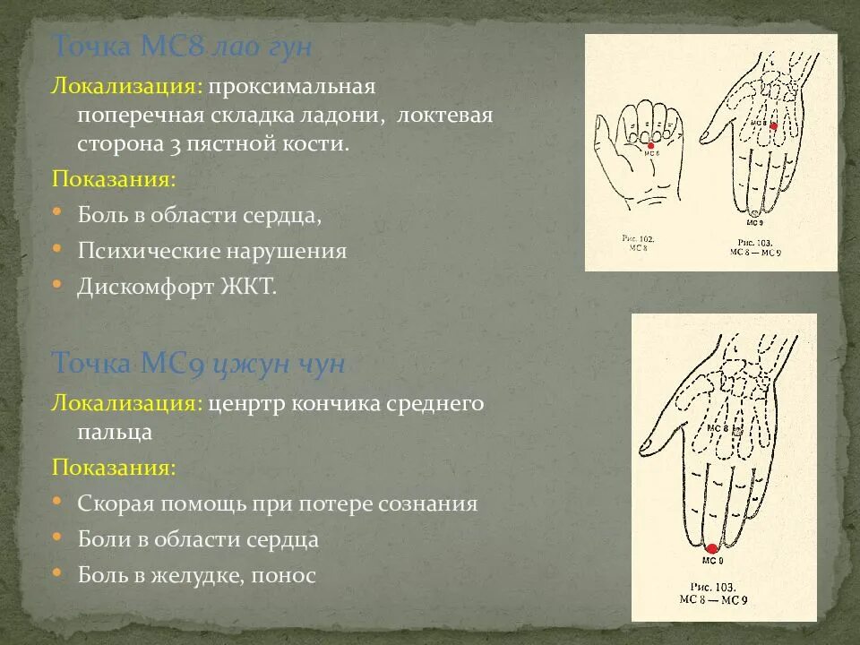 Проксимальная складка ладони. Проксимальная и дистальная складки ладони. Поперечная складка на ладони. Дистальная поперечная складка ладони.