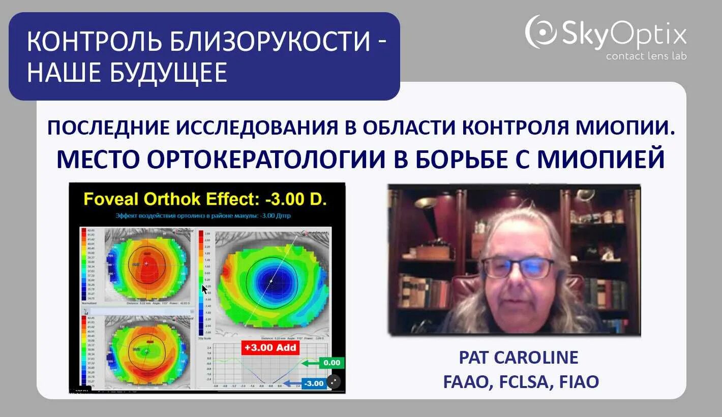 Skyoptix линзы. Контроль миопии. лаборатория skyoptix. kindlens myopia control. ортокератология в москве отзывы.