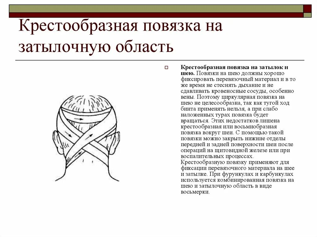 Повреждение затылка какая повязка. Восьмиобразная повязка на затылок и шею. Наложение крестообразной повязки на затылок алгоритм. Техника наложения крестообразной повязки на затылок алгоритм. Крестообразная повязка на шею алгоритм.