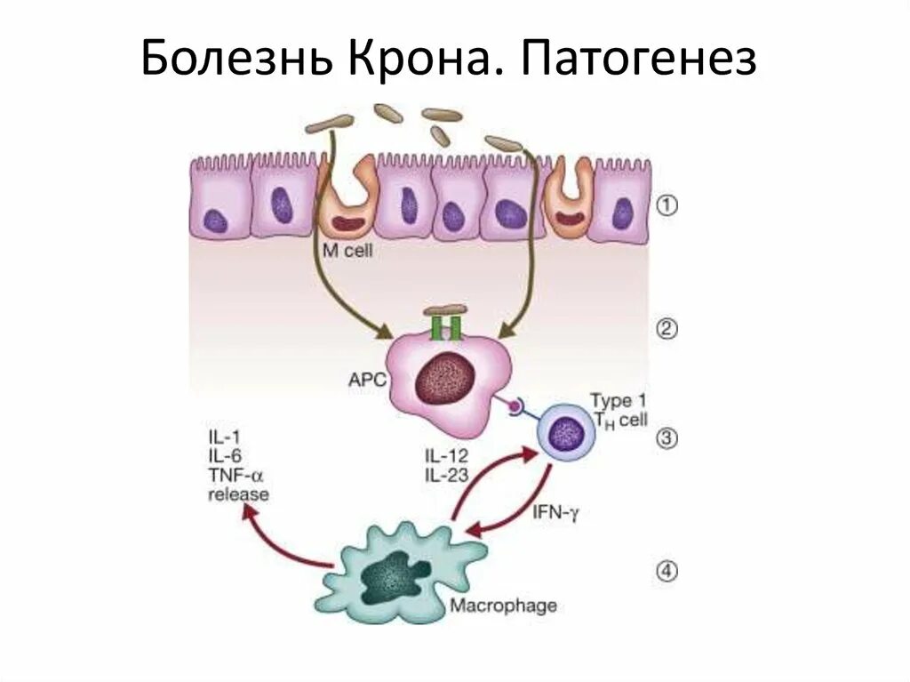 Болезнь крона патогенез схема. Болезнь крона этиология. Этиология болезни корона. Болезнь крона этиопатогенез. Крон этиология.