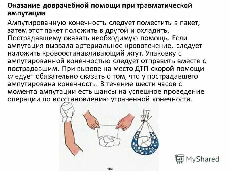 Действия при травматической ампутации