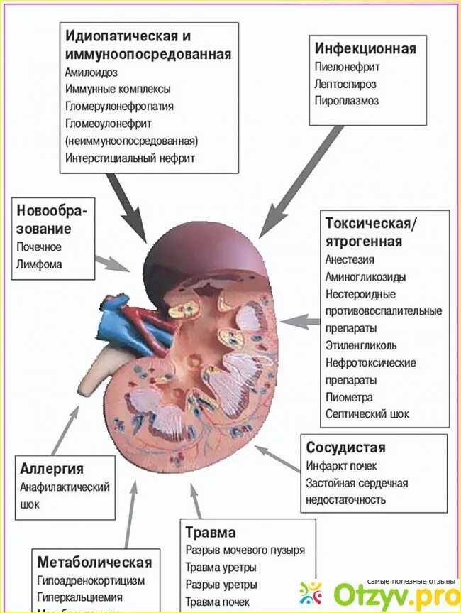 Клинические симптомы ХПН. Острая и хроническая почечная недостаточность симптомы. Факторы хронической почечной недостаточности. Причины заболевания острая почечная недостаточность. Причины почечных заболеваний