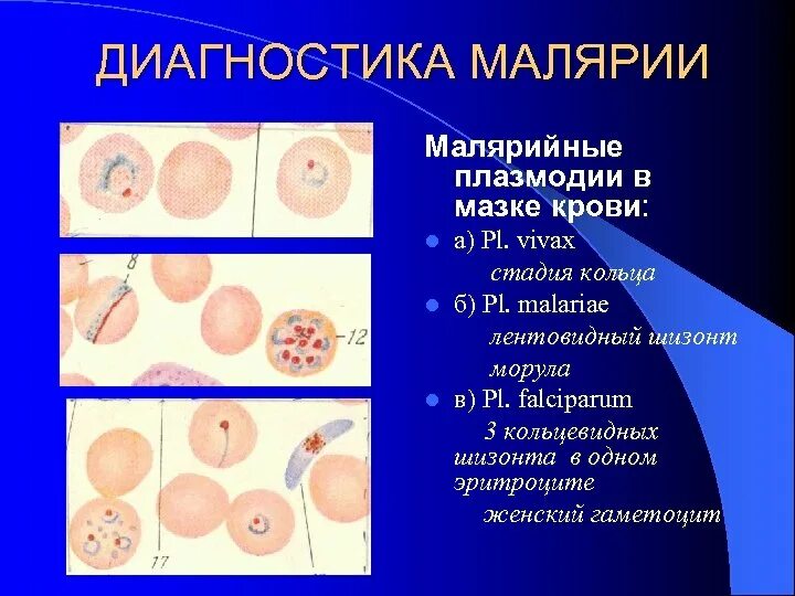 Диагностические стадии малярийного плазмодия. Диагностика 3 дневной малярии. Малярийный плазмодий этапы. Диагностическая стадия малярии.