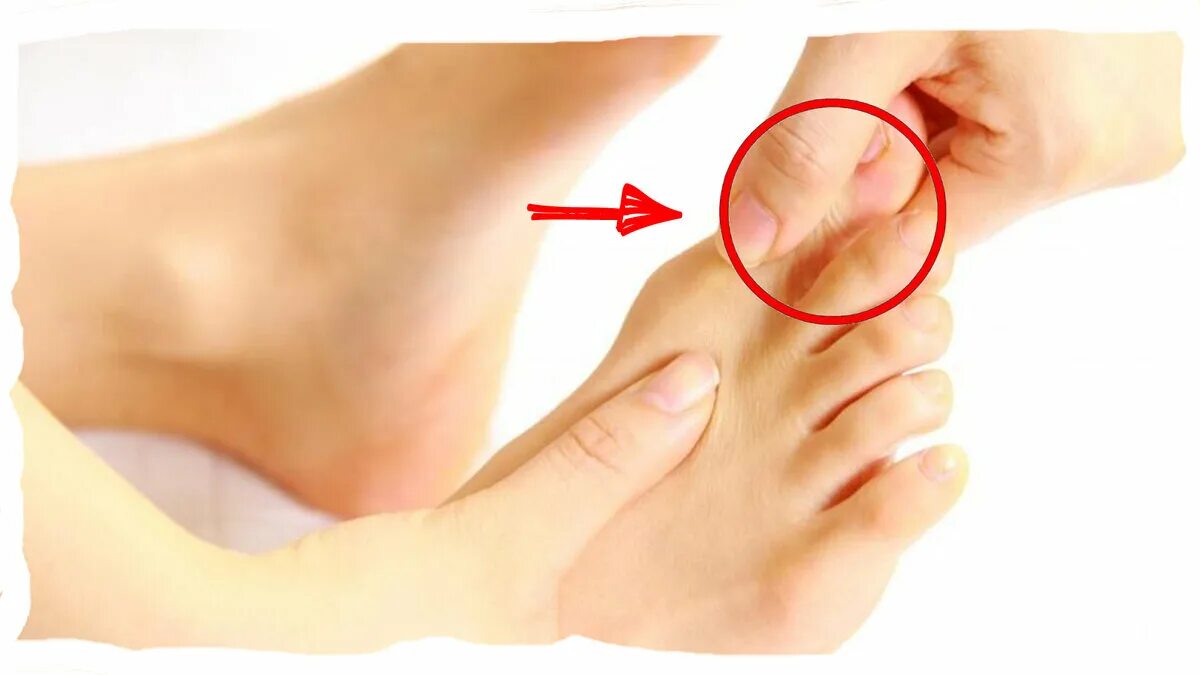 Болит большой палец ноги при ходьбе. Онемение пальцев стопы. Болит стопа у большого пальца.