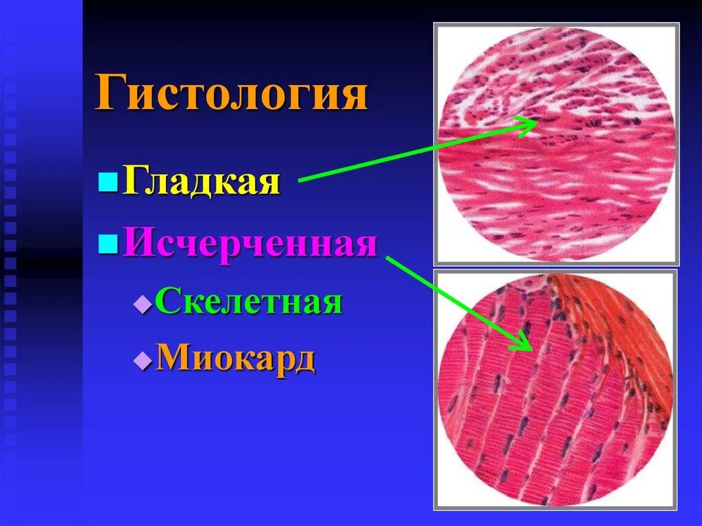 Строение клетки гладкая мышечная ткань. Мышечная ткань. Гладкая мышечная ткань гистология. Скелетная мышечная ткань гистология. Гладкая мышечная ткань гистология препарат.