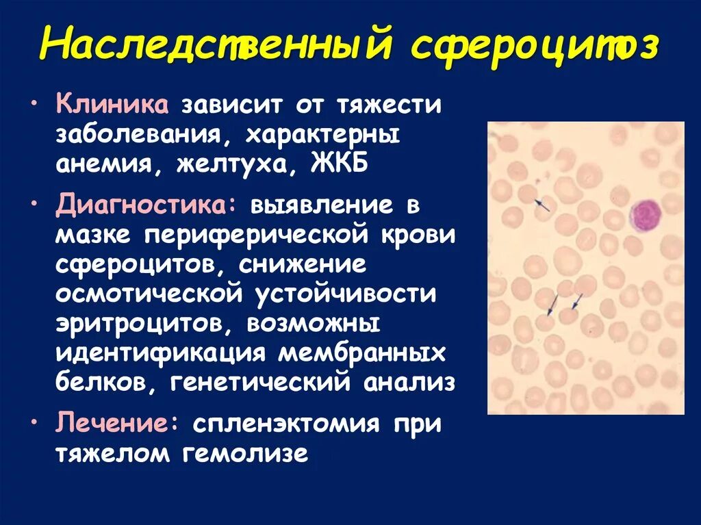 Мазок крови при выявлении патологии что это. Наследственный сфероцитоз (болезнь Минковского-Шоффара). Наследственных сыероцитоз. Сфероцитарные эритроциты. Наследственный сфероцитоз мазок крови.