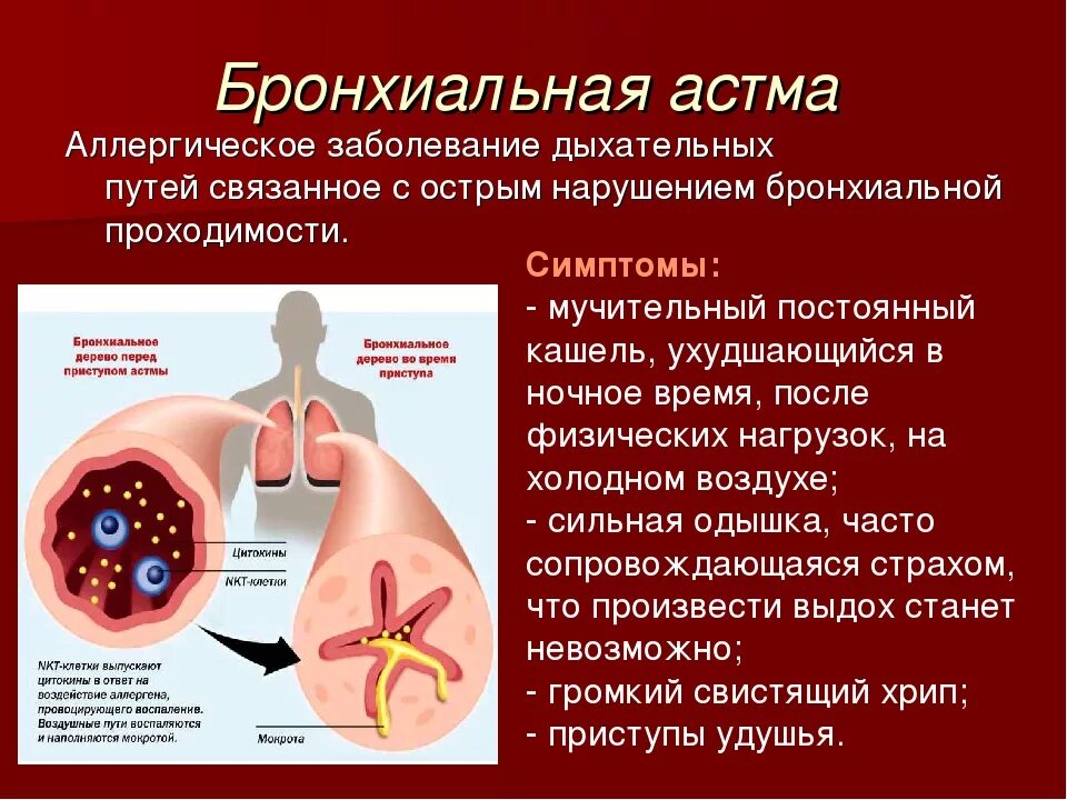 Сосудистое заболевание легких. Респираторные симптомы бронхиальной астмы. Заболевания органов дыхания бронхиальная астма. Бронхи при бронхиальной астме. Бронхов при бронхиальной астме.