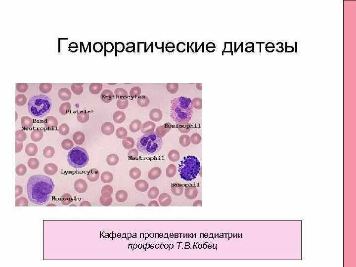 Тромбопения это. Геморрагические диатезы. Геморрагический диатез. Картина крови при геморрагическом диатезе. Геморрагические диатезы пропедевтика.