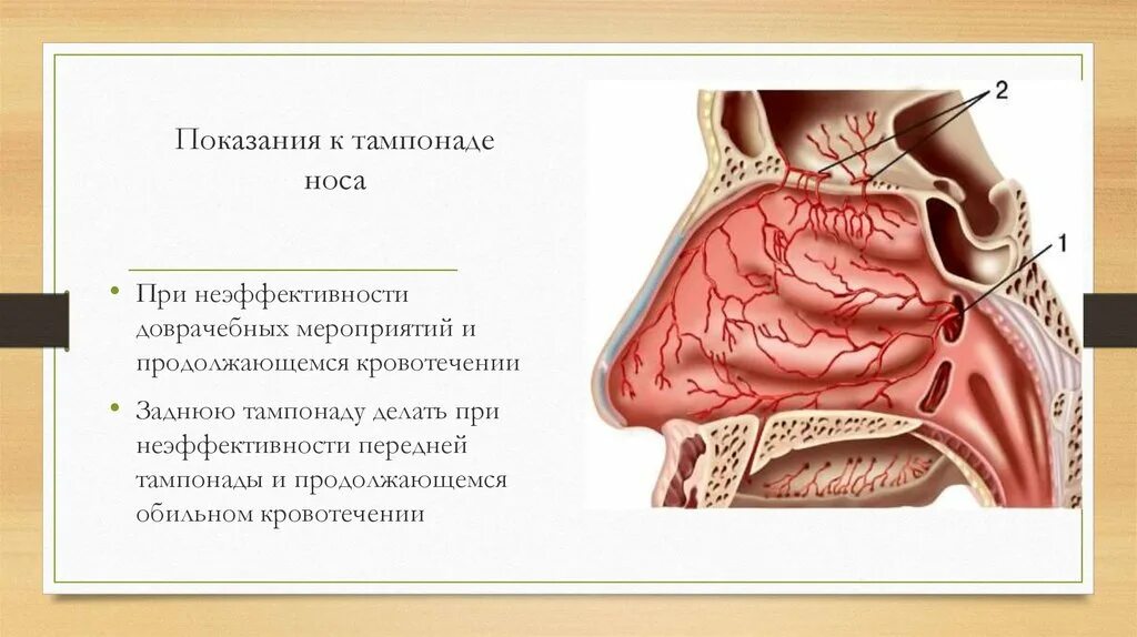 Передняя и задняя тампонада при носовом кровотечении алгоритм. Передняятомпонада носа. Передняя тампонада носа. Показания к передней тампонады носа.