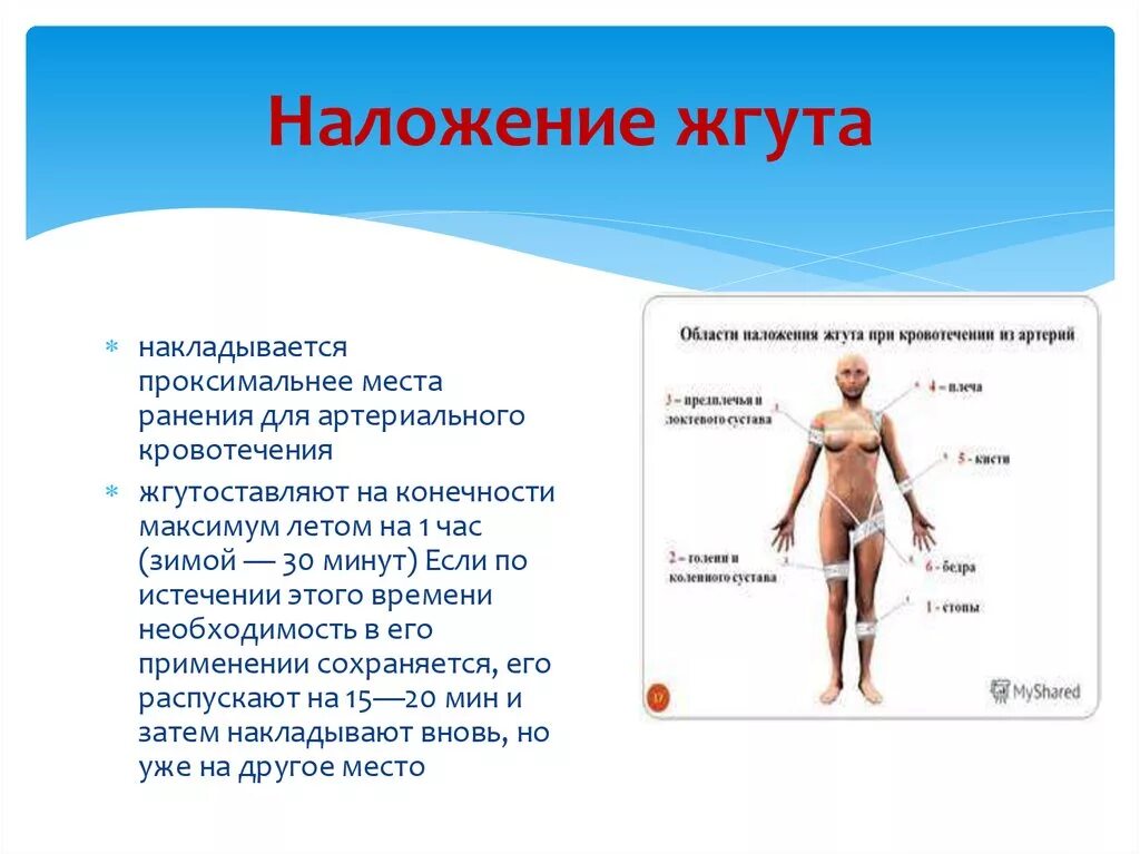 Наложение жгута летом и зимой. Время наложения жгута зимой. Максимальное время наложения жгута летом и зимой. На сколькотнакладывется жгут.