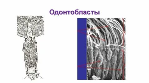 Одонтобласты пульпы